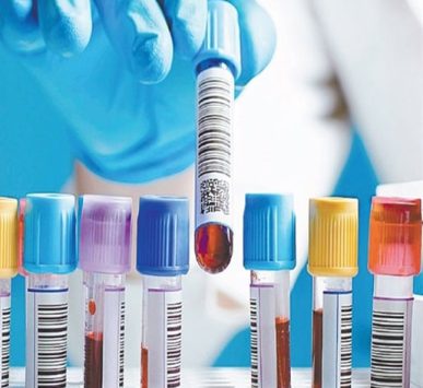 Imagen ilustrativa de inmunoanálisis clínico realizado en laboratorio moderno, con equipos automatizados y personal altamente capacitado