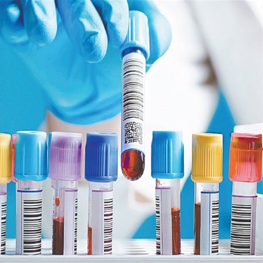 Imagen ilustrativa de inmunoanálisis clínico realizado en laboratorio moderno, con equipos automatizados y personal altamente capacitado