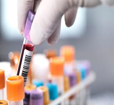 Imagen de análisis hematológico en laboratorio moderno, con tecnología automatizada y personal experto en estudios de sangre