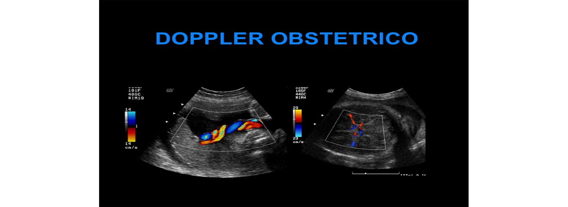 Ecografía Doppler obstétrico en Moderna Salud para evaluar el flujo sanguíneo del bebé y la placenta, garantizando un control seguro del embarazo