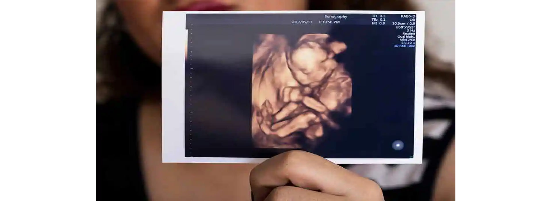 Ecografía morfológica en Moderna Salud para evaluar el desarrollo y bienestar del bebé durante el embarazo