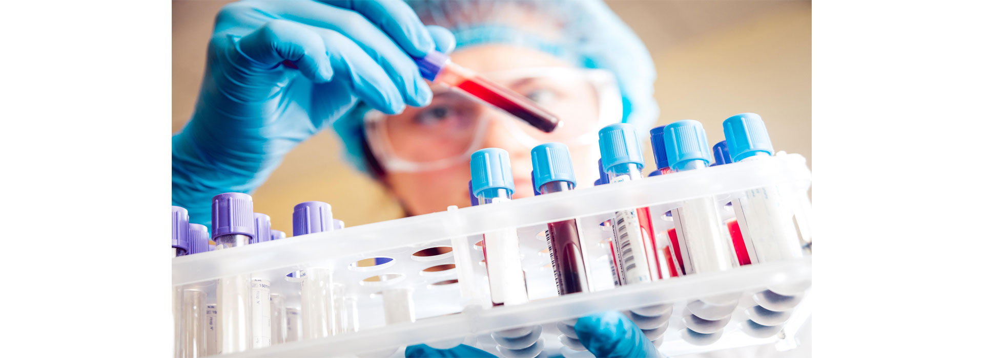 Servicio de inmunoanálisis confiable para la detección de anticuerpos, antígenos y marcadores biológicos